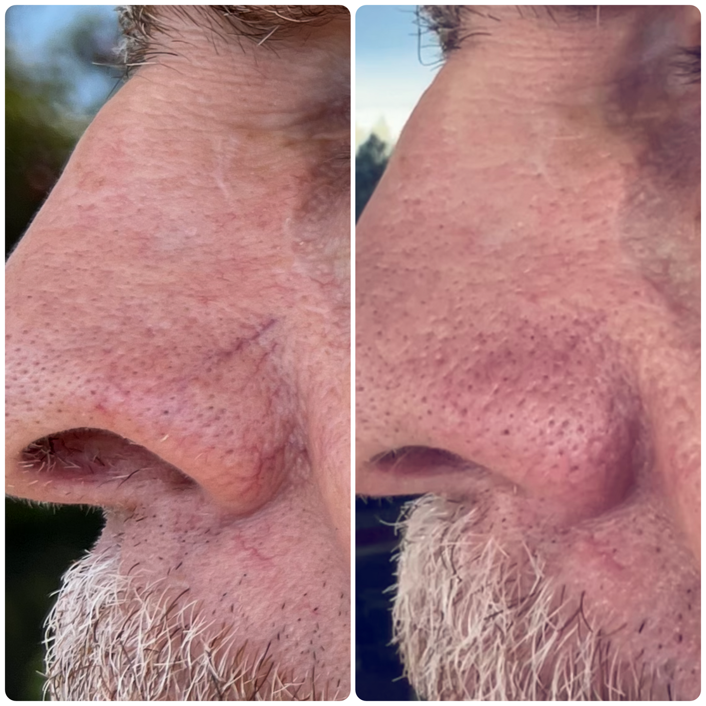 Solas IPL Pro