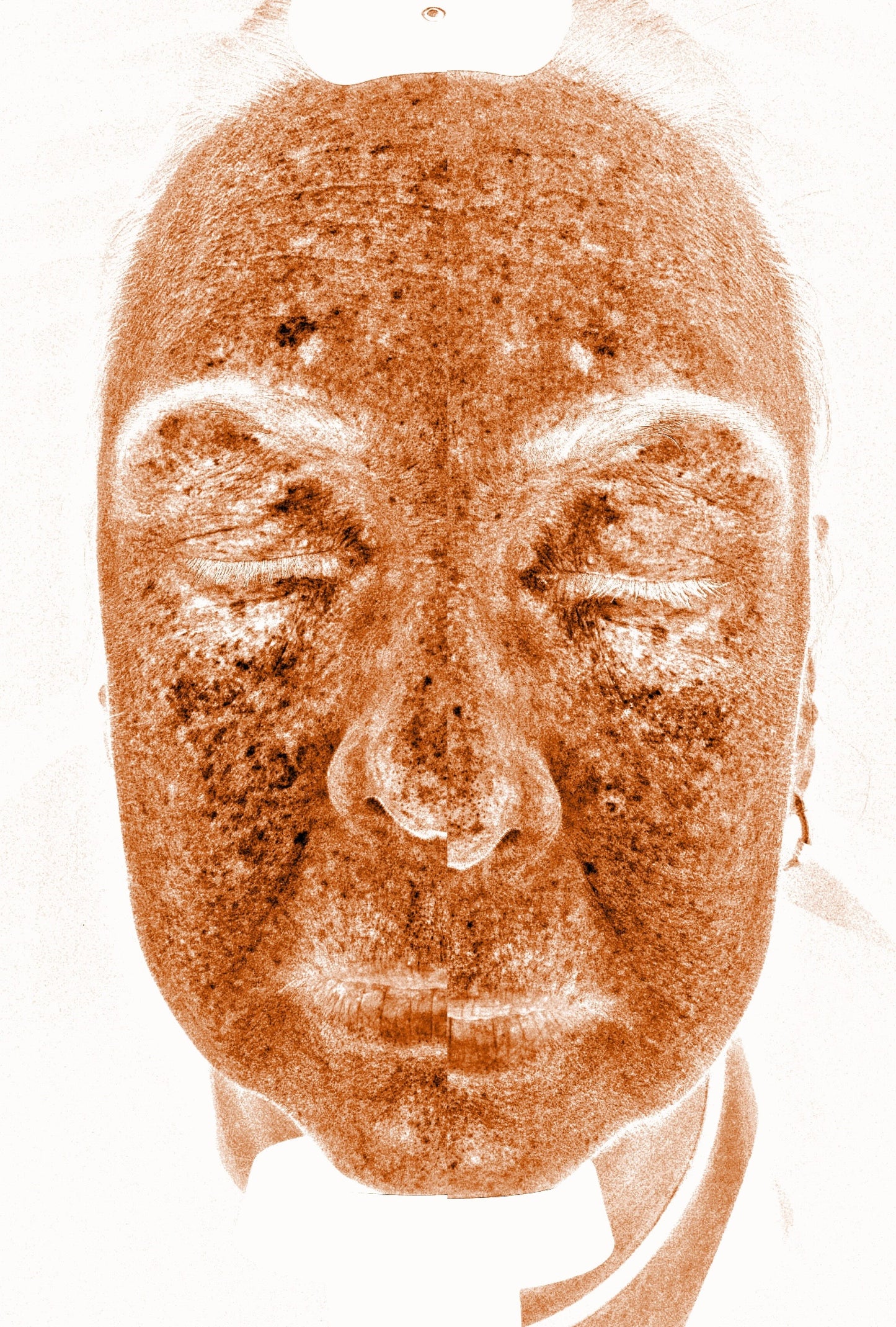 Solas Pro-D Skin Analyzer